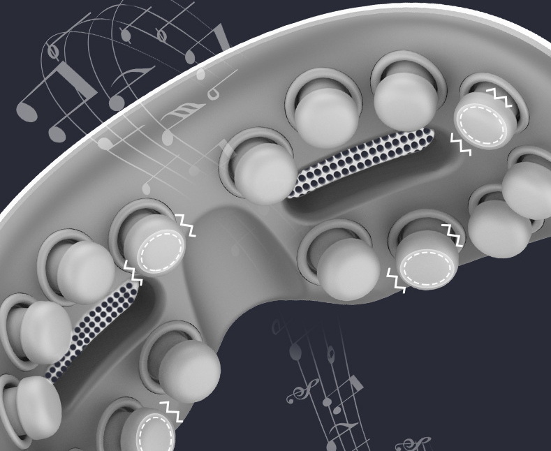 Аудиотерапия